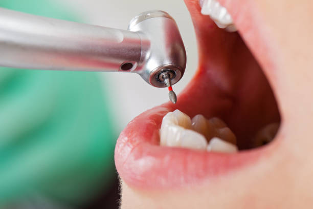 Best Walk-In Emergency Dentist in Glendale, WI